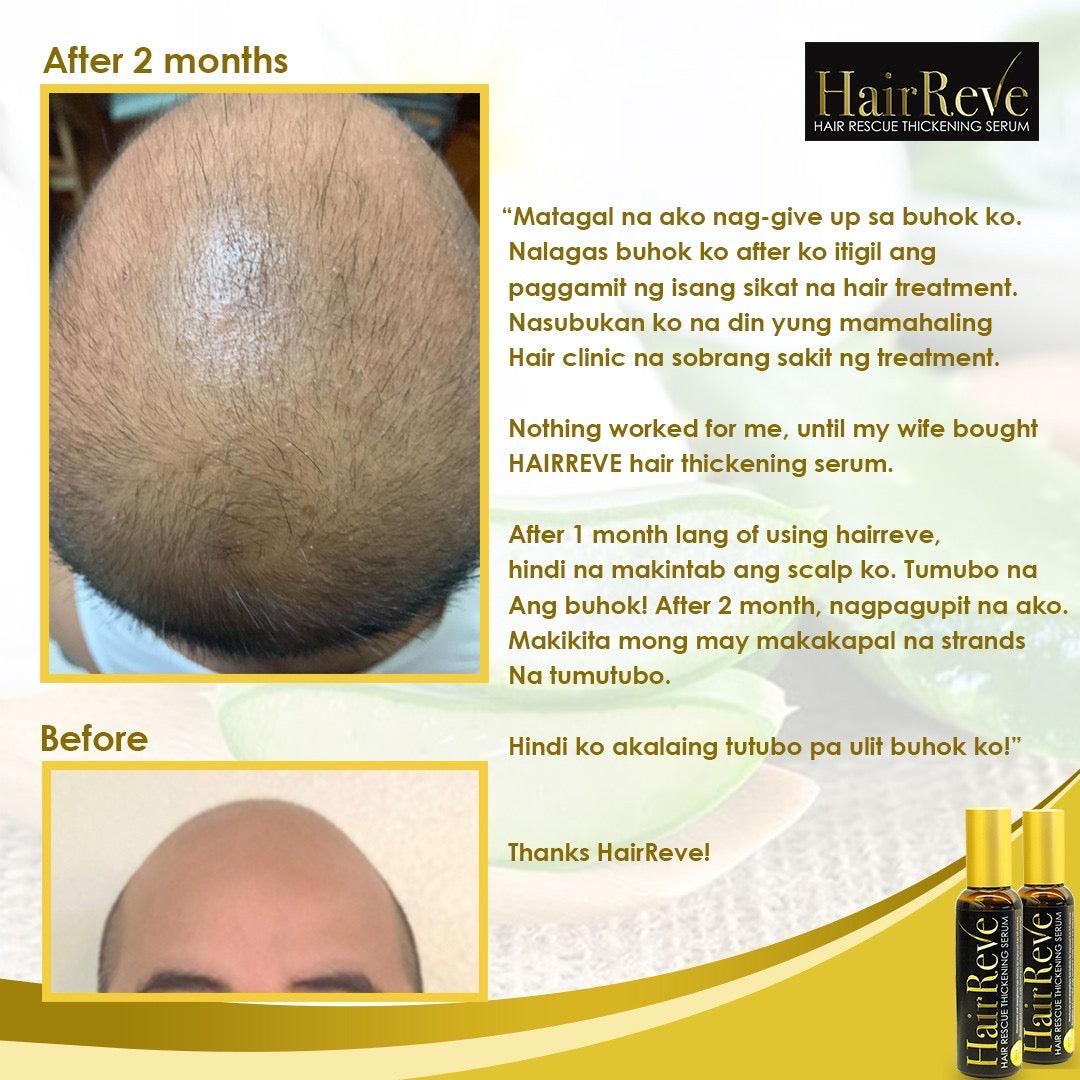 Hairreve Hair Rescue Thickening Serum 100ml - 1-2 Months Supply - HairReve