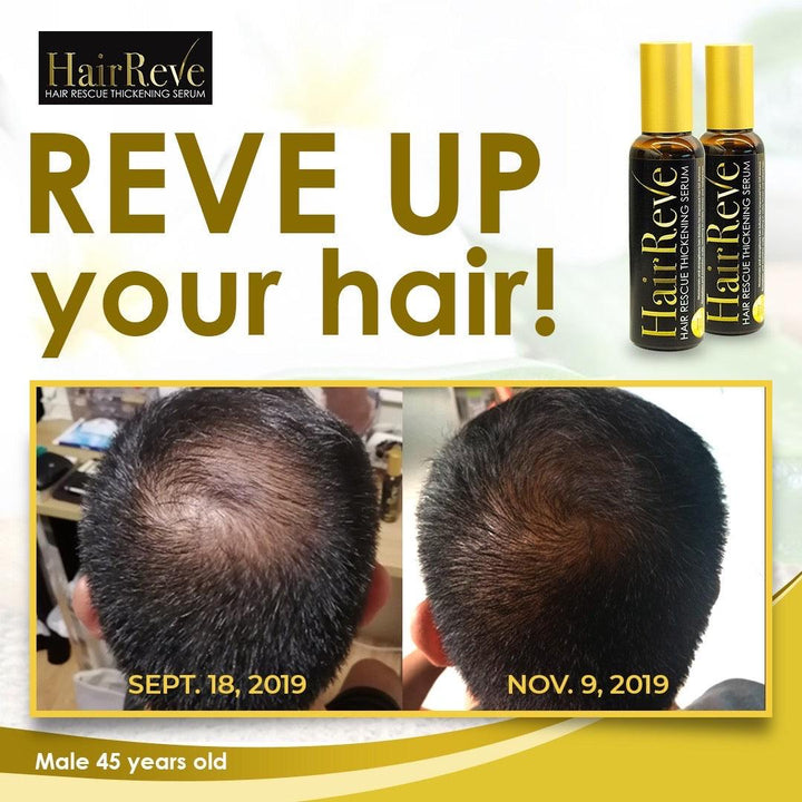 Hairreve Hair Rescue Thickening Serum 100ml - 1-2 Months Supply - HairReve