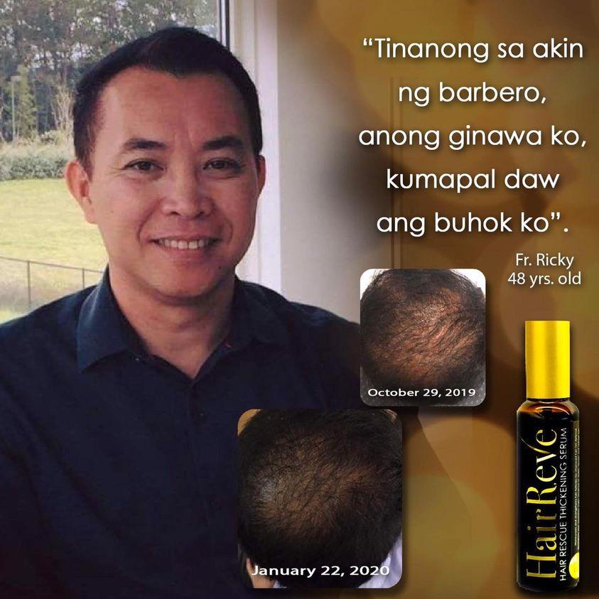 Hairreve Hair Rescue Thickening Serum 100ml - 1-2 Months Supply - HairReve