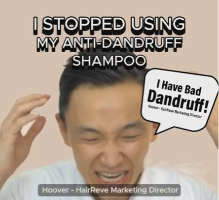 I have bad dandruff! I stopped using my Anti-Dandruff Shampoo