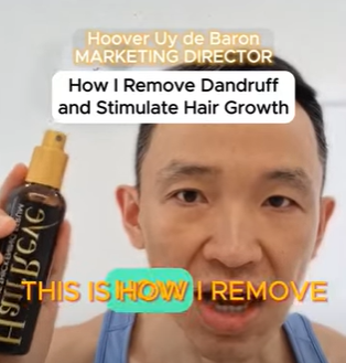 How I Remove Dandruff and Stimulate Hair Growth