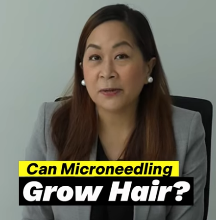 Can Microneedling Grow Hair?