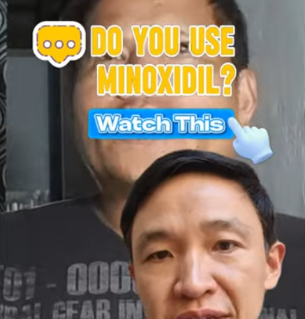 Do you Use Minoxidil? Watch This. 💡