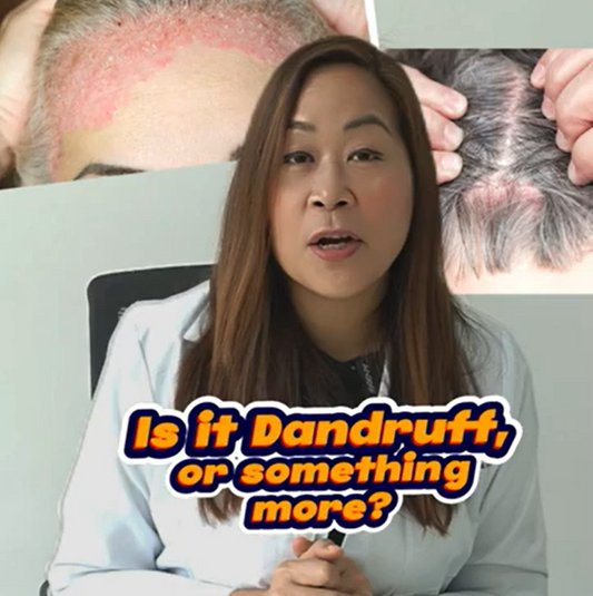 Is it Dandruff, or Something More? 🤔❄️