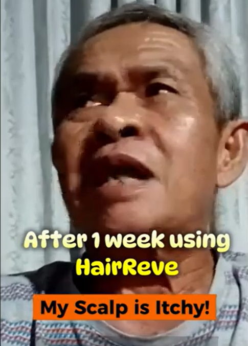 After 1 Week Using HairReve, My Scalp is Itchy?! 🤯🧐