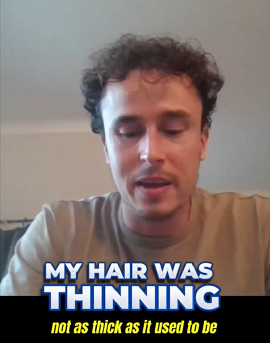 My hair was thinning… not as thick as it used to be 😔