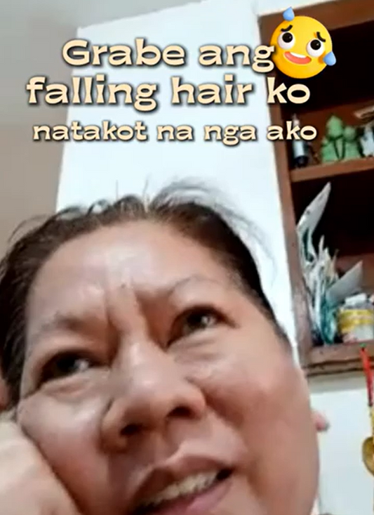 Grabe ang falling hair ko, natakot na nga ako!😨