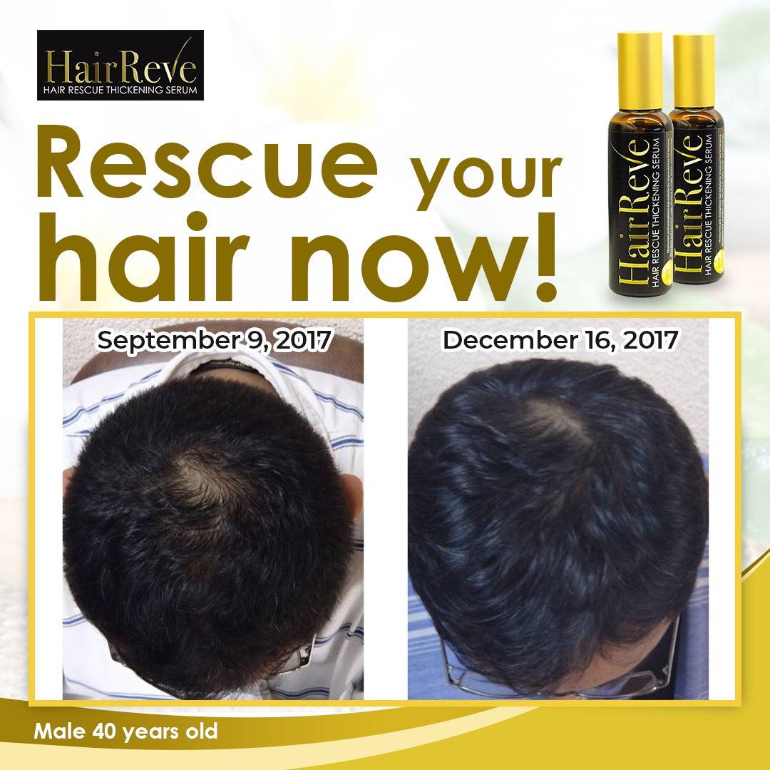 Hairreve Hair Rescue Gift Set - Thickening Serum, Sulfate-Free Shampoo & Scalp Massager / Hair Brush - 100ml each - HairReve