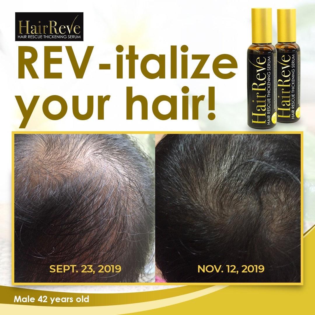 Hairreve Hair Thickening Serum & Sulfate-Free Shampoo Bundle 100ml each - HairReve
